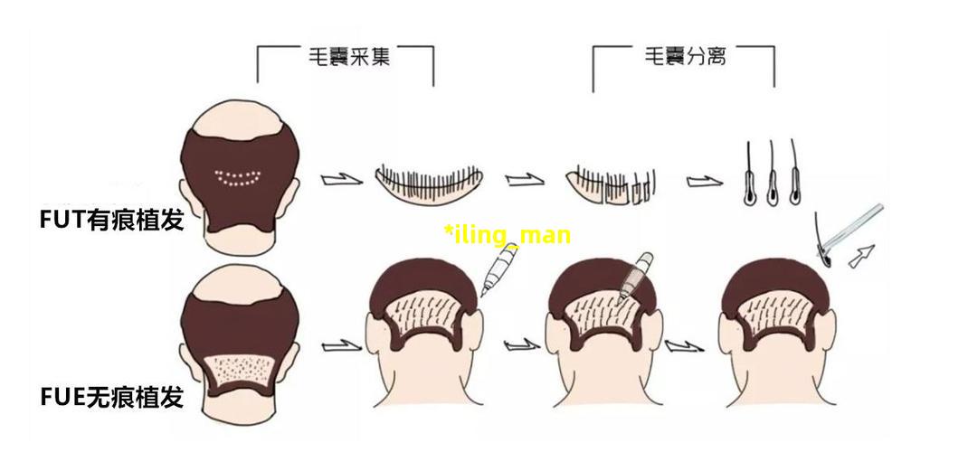 *iling man