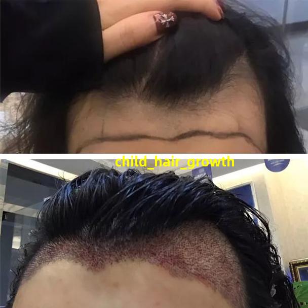 child hair growth