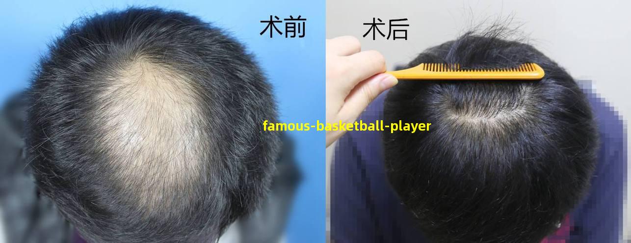 Basketball Player