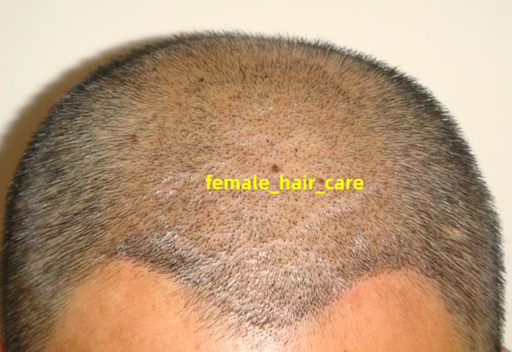 female hair care