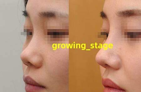 growing_stage