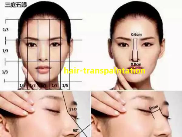 Hair Transplantation