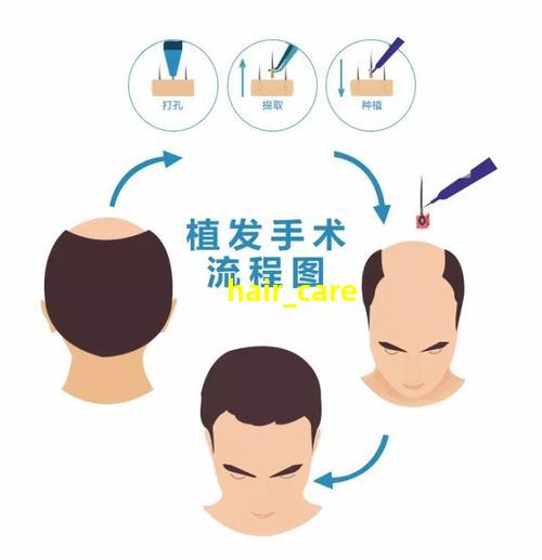 护发方法