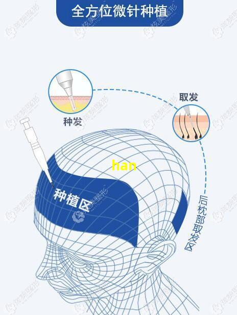 哈恩防脱洗发水