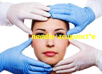 needle acupunct*e