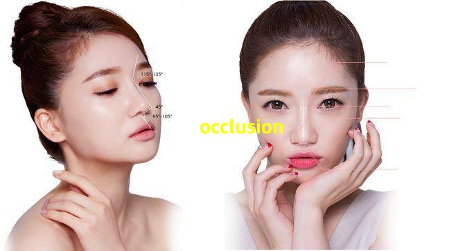 occlusion