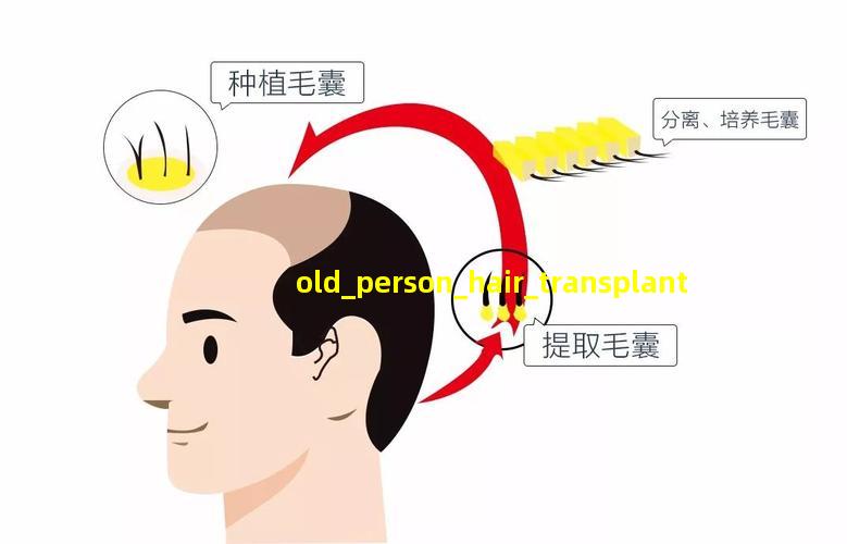 老年人植发