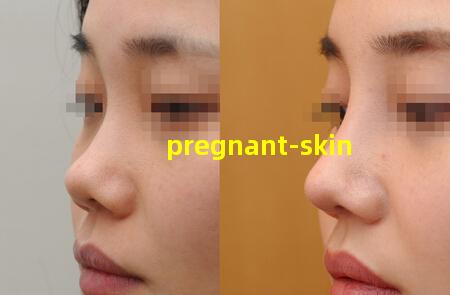 pregnant-skin