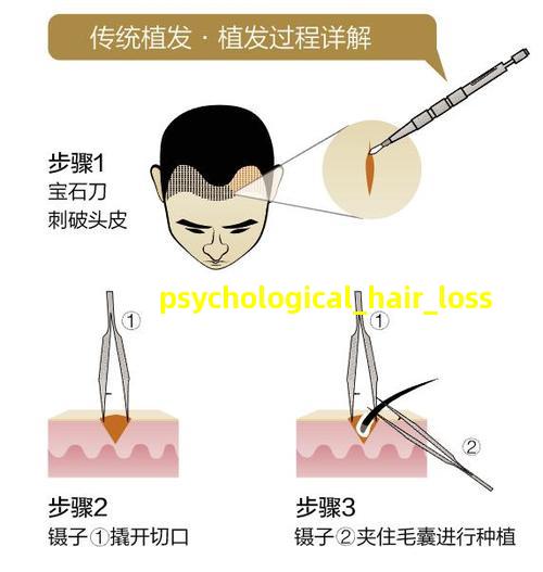 Psychological Hair Loss