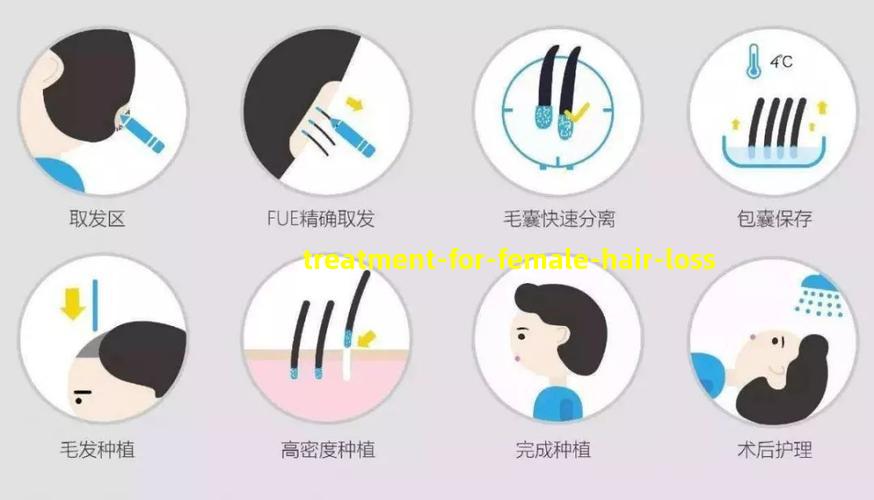 treatment-for-female-hair-loss