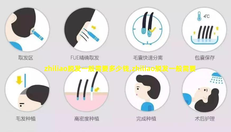 zhiliao脱发一般需要多少钱,zhiliao脱发一般需要多少钱费用