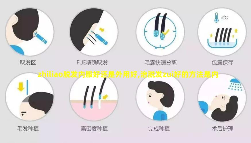 zhiliao脱发内服好还是外用好,治脱发zui好的方法是内服还是外用好