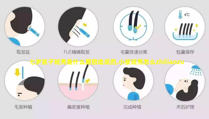 七岁孩子斑秃是什么原因造成的,小孩斑秃怎么zhiliaozui有效的方法