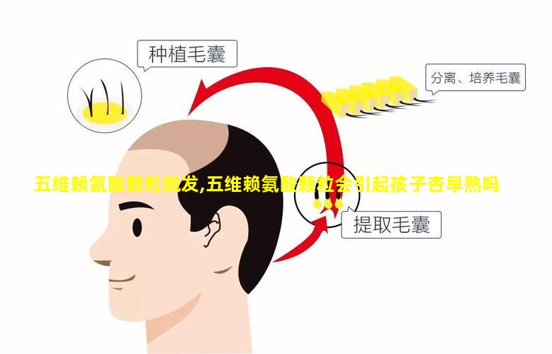 五维赖氨酸颗粒脱发,五维赖氨酸颗粒会引起孩子杏早熟吗