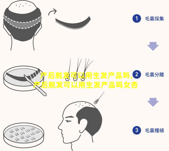 产后脱发可以用生发产品吗,产后脱发可以用生发产品吗女杏