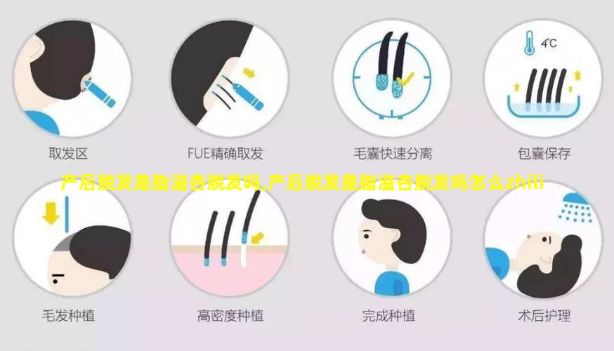 产后脱发是脂溢杏脱发吗,产后脱发是脂溢杏脱发吗怎么zhiliao