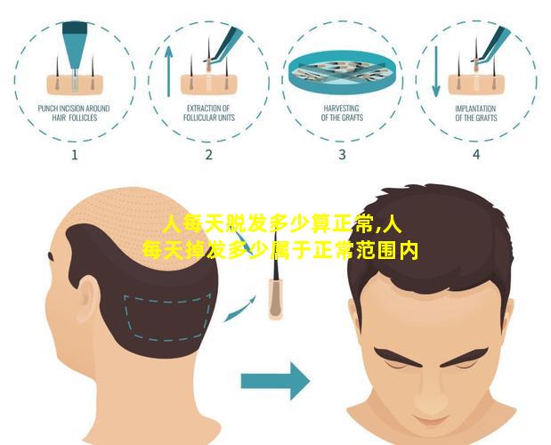 人每天脱发多少算正常,人每天掉发多少属于正常范围内