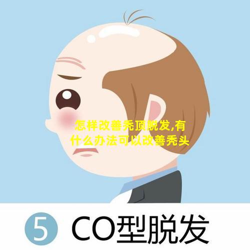 怎样改善秃顶脱发,有什么办法可以改善秃头