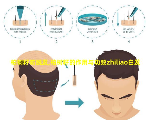 柏树籽防脱发,柏树籽的作用与功效zhiliao白发